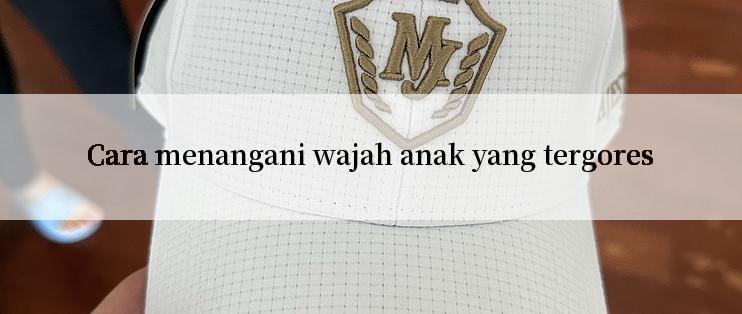 Cara menangani wajah anak yang tergores